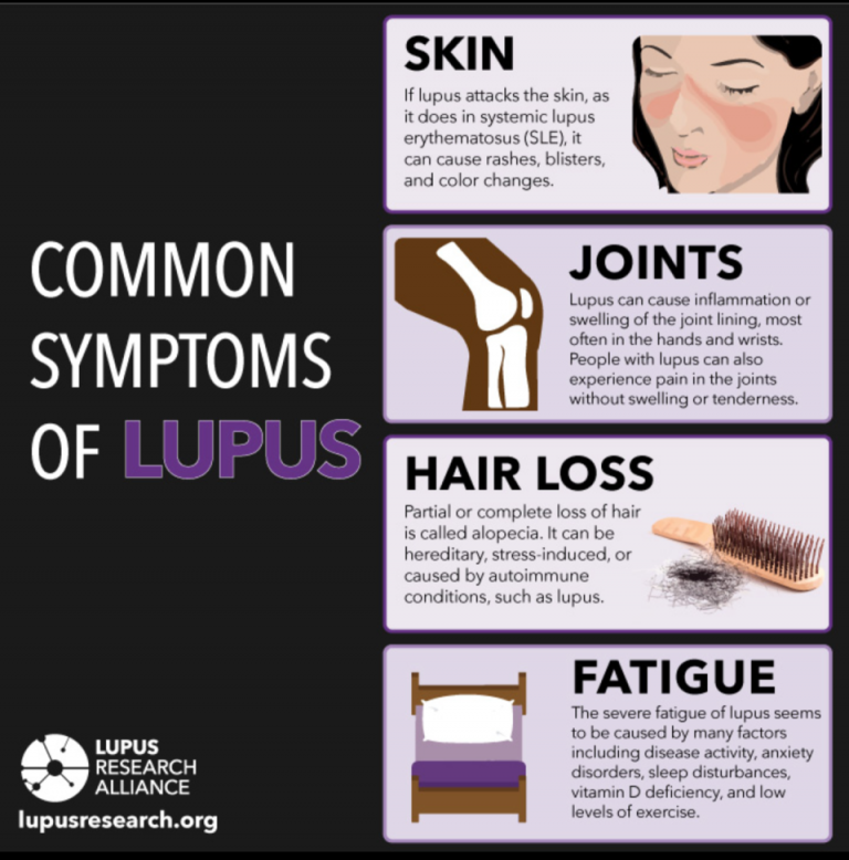 Lupus Awareness  But What Is Lupus Chart 1 768x778 